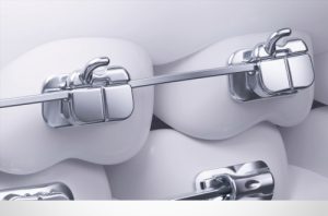 SLX on teeth 3D Render