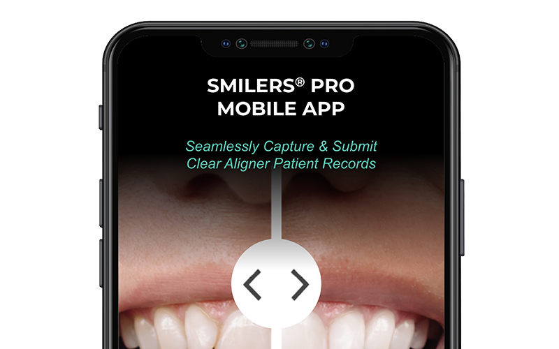Smilers Pro app open on a phone